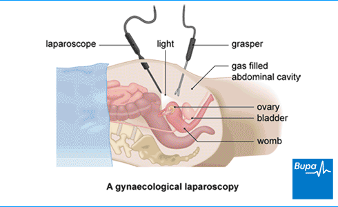 Urogynaecology