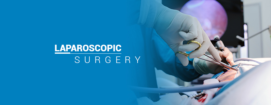 laparoscopy surgery