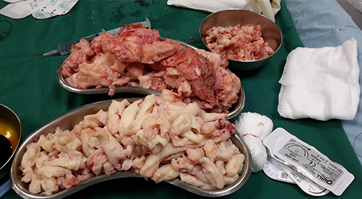 Gynaec Endoscopic Surgeon in Pune